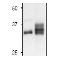 FNR3 | Ferredoxin  NADP Reductase, isoprotein 3 (leaf) in the group Antibodies Plant/Algal  / Photosynthesis  / Electron transfer at Agrisera AB (Antibodies for research) (AS20 4437)